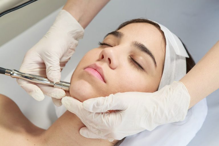 microdermoabrasion tratamiento